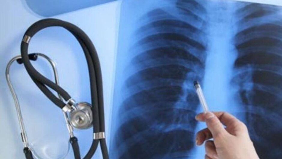 Τήνος: Κατέφυγε στον… κτηνίατρο για ακτινογραφία λόγω βλάβης στο κέντρο υγείας