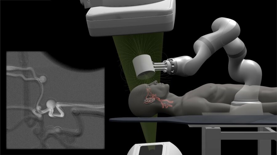 Νευροχειρουργοί στο ΜΙΤ αντιμετωπίζουν τα εγκεφαλικά από μακριά με τηλερομποτικό σύστημα