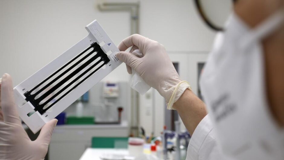 Ηλίας Μόσιαλος / Tι γνωρίζουμε για το κύμα οξείας ηπατίτιδας σε παιδιά