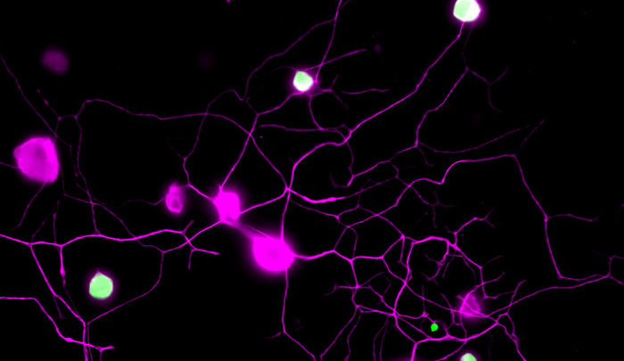 Σπάει ο φαύλος κύκλος του καρκίνου και του πόνου