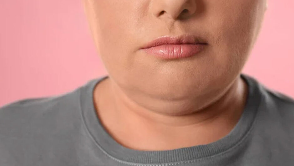 Προγούλι: Τι να κάνετε για να απαλλαγείτε μια και καλή από αυτό