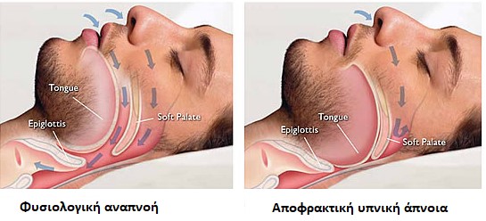 O ανεπαρκής ύπνος αυξάνει την όρεξη με αποτέλεσμα την αύξηση του σωματικού βάρους