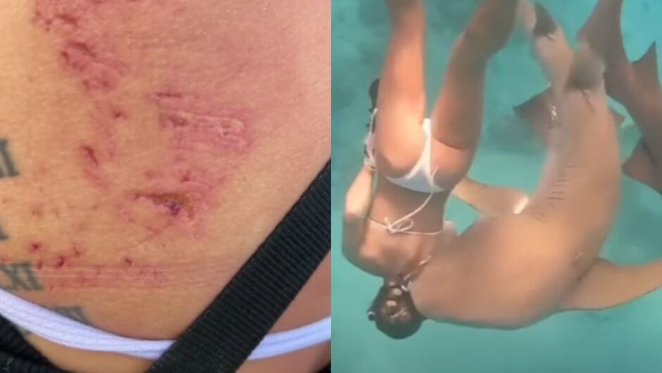 Στιγμές τρόμου για κολυμβήτρια: Τη δάγκωσε καρχαρίας 100 κιλών