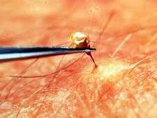 Κεντρίσματα…