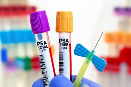 PSA: Η ΕΞΕΤΑΣΗ ΠΟΥ ΠΡΕΠΕΙ ΝΑ ΚΑΝΕΙ ΚΑΘΕ ΑΝΤΡΑΣ ΜΕΤΑ ΤΑ 45