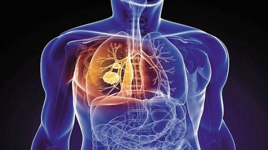 Οι επιστήμονες κρούουν τον κώδωνα του κινδύνου – Μισό εκατομμύριο Έλληνες πάσχουν από ΧΑΠ και δεν το ξέρουν