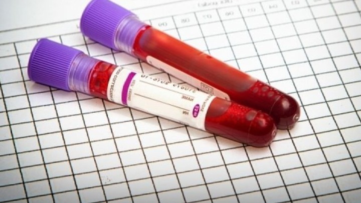 Οι ανάγκες της Ελλάδας σε αίμα – Τα νοσοκομεία με τις καλύτερες επιδόσεις