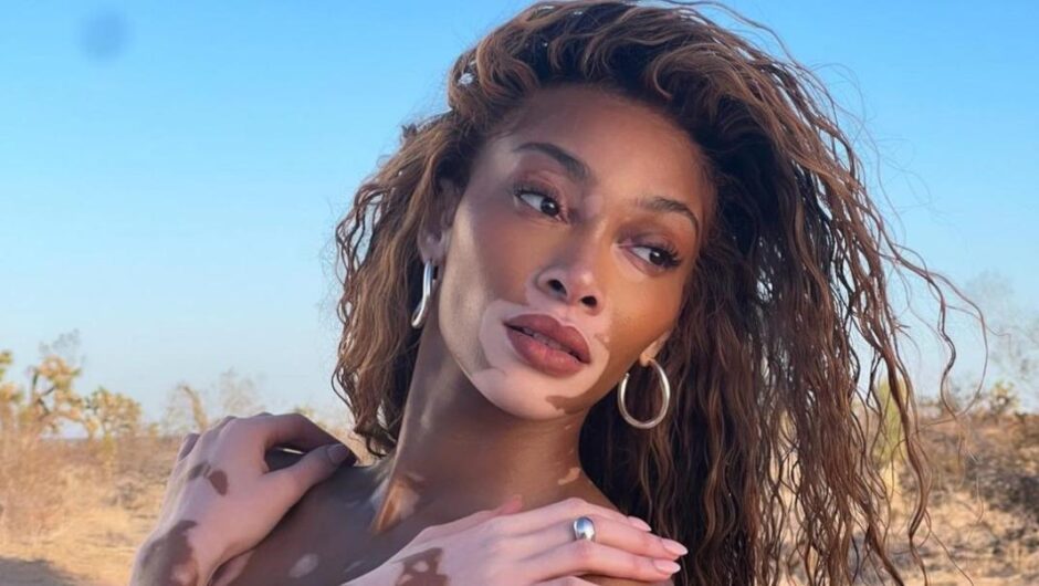 H Γουίνι Χάρλοου ποζάρει εντελώς γυμνή για εξώφυλλο περιοδικού