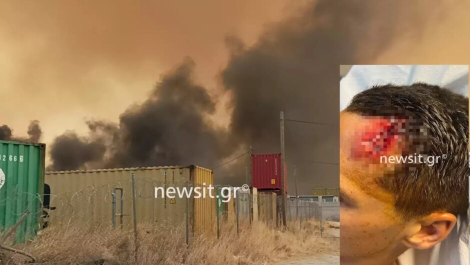 Φωτιά στον Ασπρόπυργο: Φωτογραφία ντοκουμέντο με τον τραυματία αστυνομικό στον οποίο επιτέθηκαν με τσιμεντόλιθο