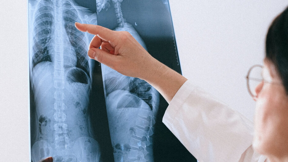 Χρόνια αποφρακτική πνευμονοπάθεια (ΧΑΠ): Η διατροφή που βελτιώνει την ποιότητα ζωής των ασθενών