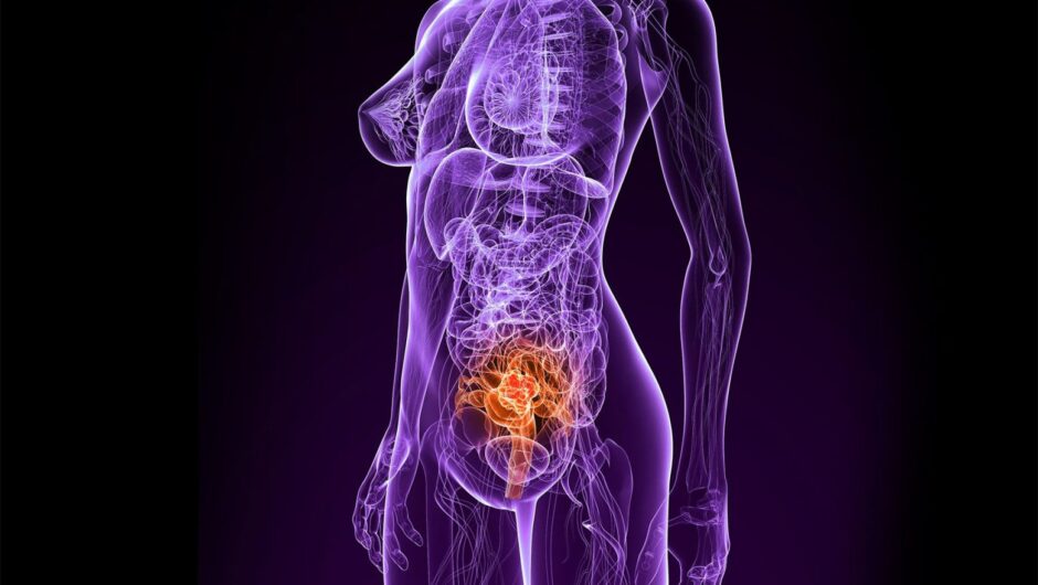 Σελφ τεστ για τον καρκίνο του τραχήλου