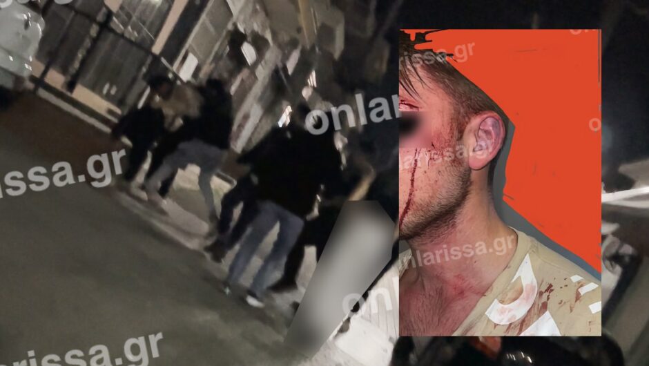 Βίντεο και φωτογραφίες που σοκάρουν: Θύμα άγριου ξυλοδαρμού νεαρός στο κέντρο της Λάρισας!