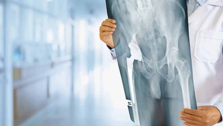 Γιατροί είδαν ακτινογραφία από το πέος άνδρα και δεν πίστευαν στα μάτια τους – Ο ασθενής πήγε στο νοσοκομείο με οξείς πόνους