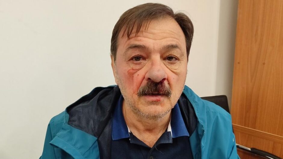 Βόλος / Μασκοφόρος ξυλοκόπησε δημοτικό σύμβουλο – Το σοκ όταν του έβγαλαν τη μάσκα