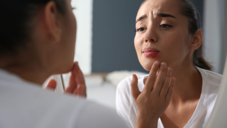 Επιχείλιος έρπης: Ο ύπουλος και εξαιρετικά μεταδοτικός ιός