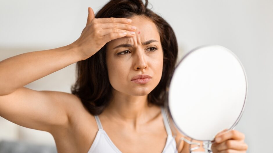 5 λάθη που κάνετε όταν βγάζετε σπυράκια & πώς θα τα αποφύγετε