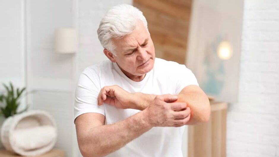 Ήπαρ: 3 σημάδια στο δέρμα που μαρτυρούν ότι ο «φύλακας» της υγείας νοσεί