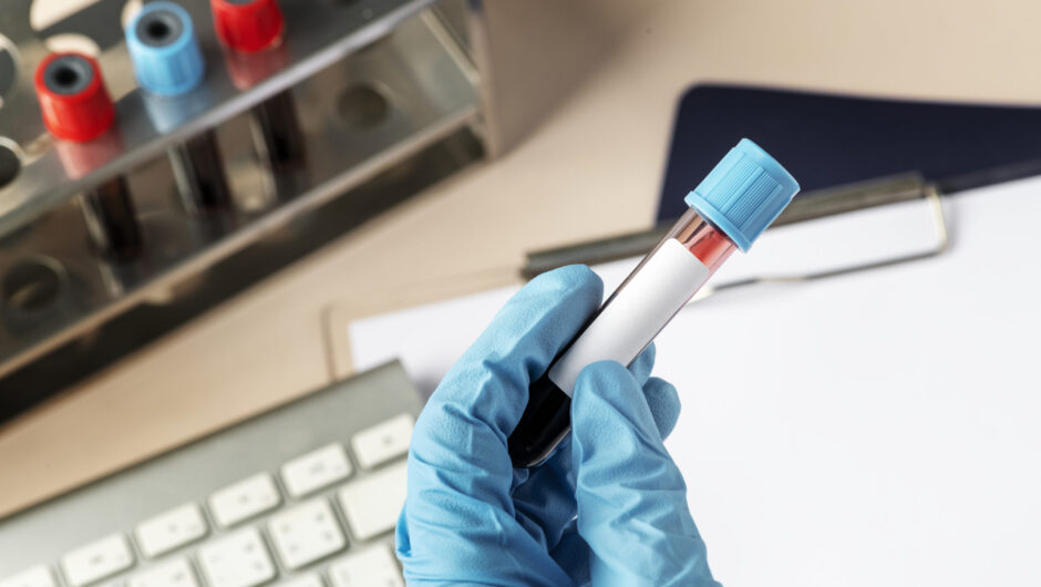 Kαρδιακές παθήσεις: Οι ομάδες αίματος που συνδέονται με υψηλότερο κίνδυνο, σύμφωνα με μελέτες