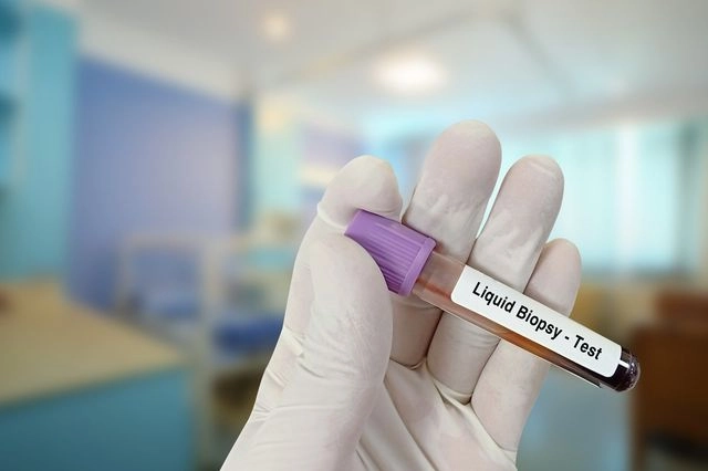 Κολονοσκόπηση τέλος: Εξέταση ανιχνεύει με ακρίβεια 95% τον καρκίνο του εντέρου