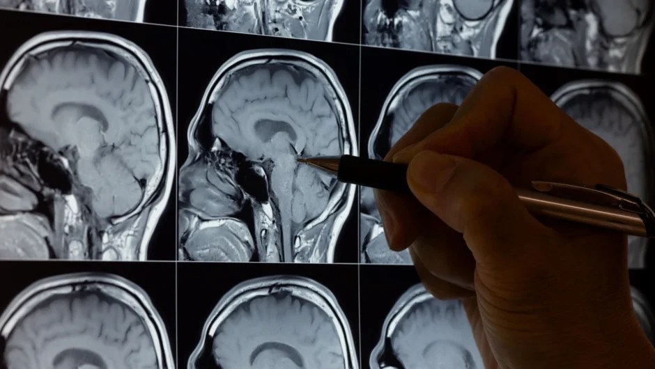 Οι ανθρώπινοι εγκέφαλοι γέρασαν ραγδαία στην πανδημία – και το πρόβλημα δεν ήταν μόνο ο κορονοϊός