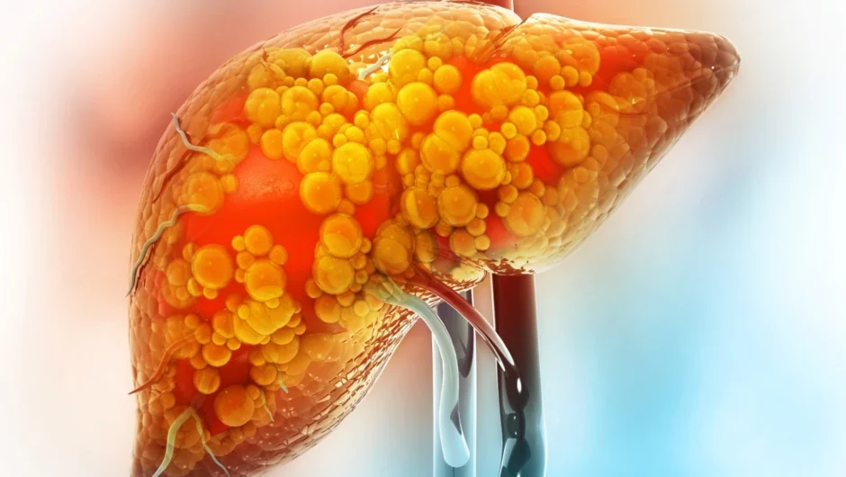 3 από τις 5 περιπτώσεις καρκίνου του ήπατος μπορούν να προληφθούν – Δείτε με ποιους τρόπους
