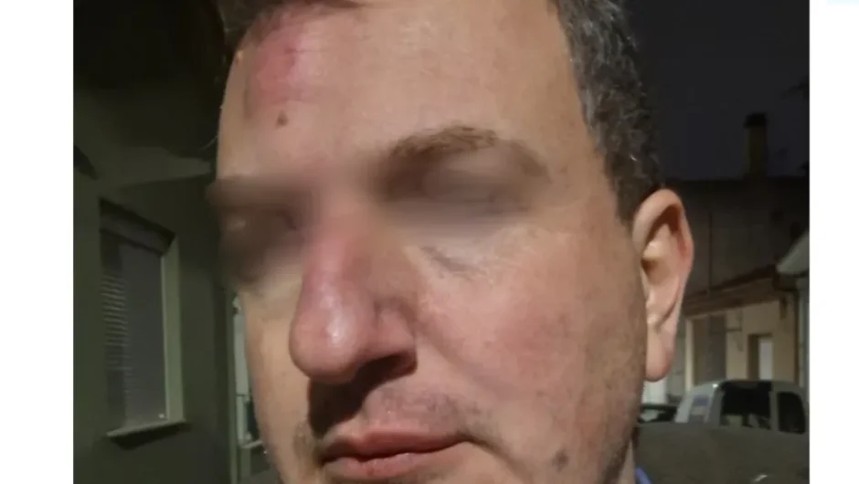 Βόλος στον γύψο