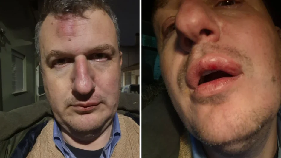 Εκδότης «Μαγνησίας»: «Η αστυνομία δεν προέβη ούτε στα αυτονόητα» – Ποιους φωτογραφίζει για τον ξυλοδαρμό του